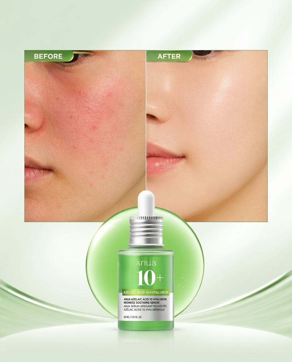 Anua Azelaic Acid 10+ Hyaluron Redness Soothing Serum – 30ml