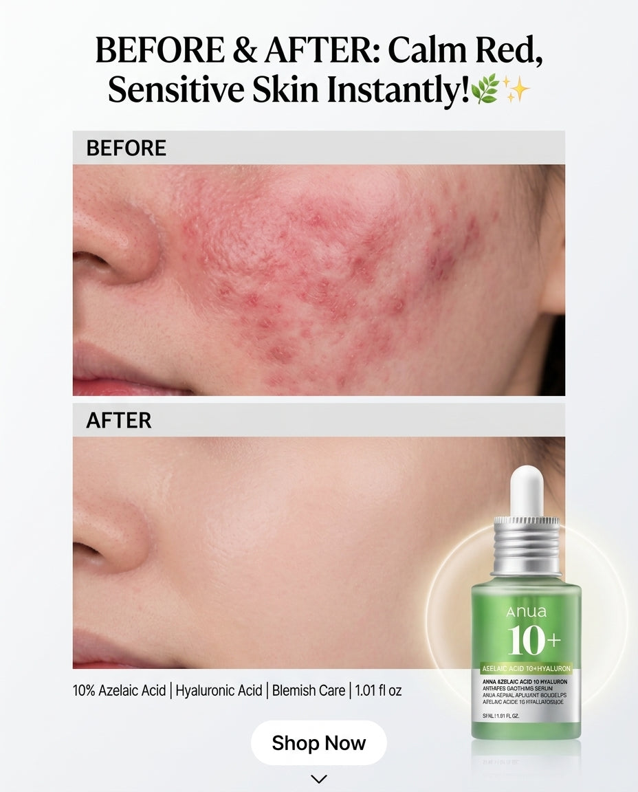 Anua Azelaic Acid 10+ Hyaluron Redness Soothing Serum – 30ml