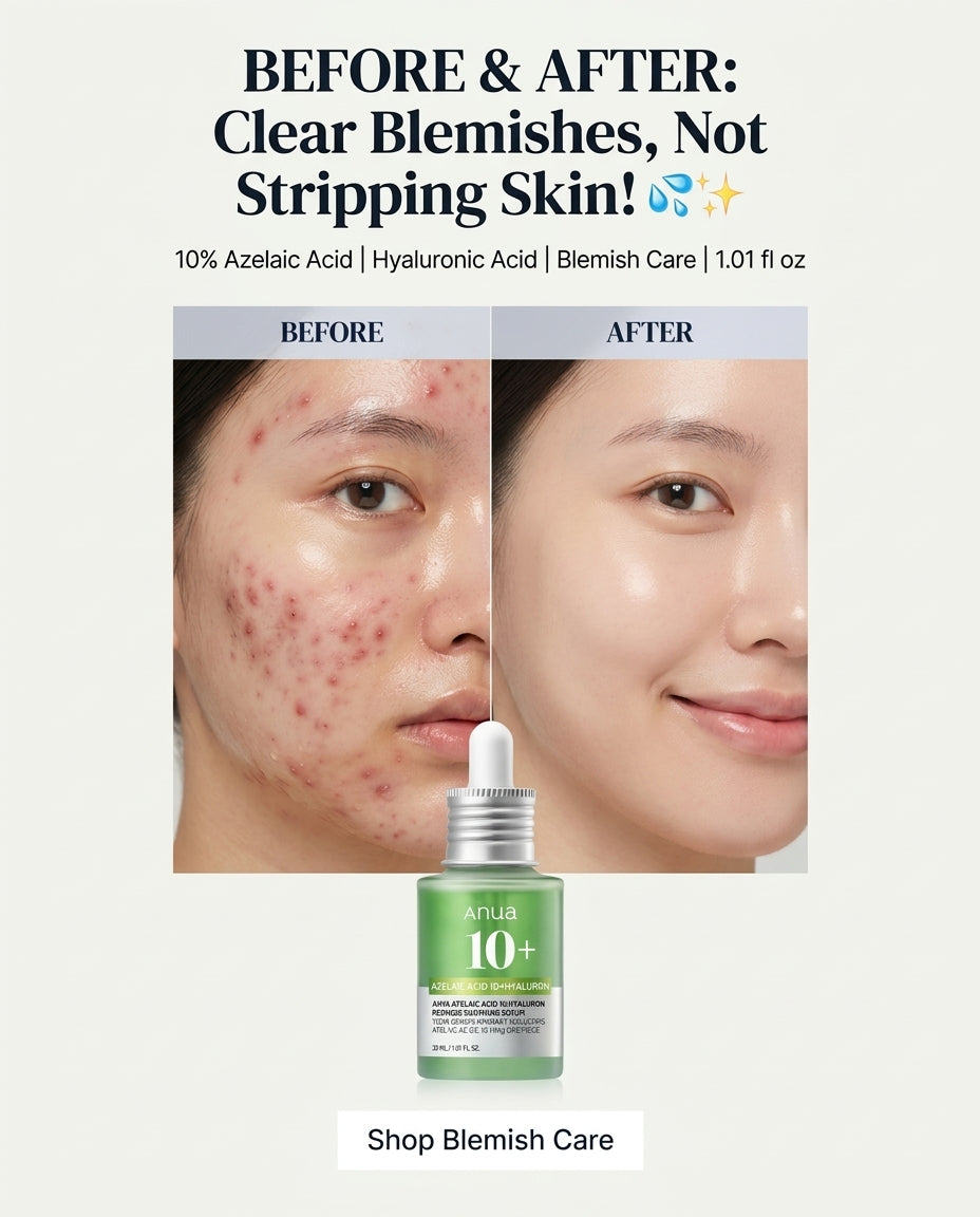Anua Azelaic Acid 10+ Hyaluron Redness Soothing Serum – 30ml