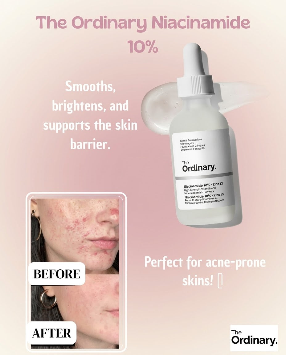 The Ordinary Niacinamide 10% + Zinc 1% – High-Strength Blemish Serum 30ml